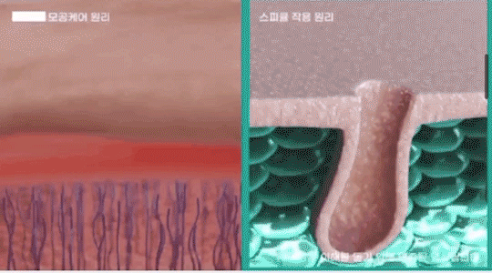 微针gif-2.gif